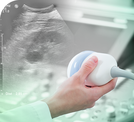 image of ultrasound doppler